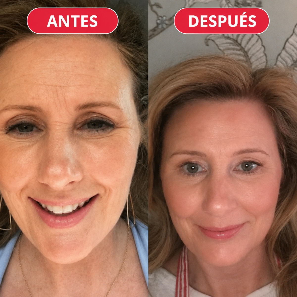 CENTELLIAN 24 madeca cream time reverse (todo en uno)